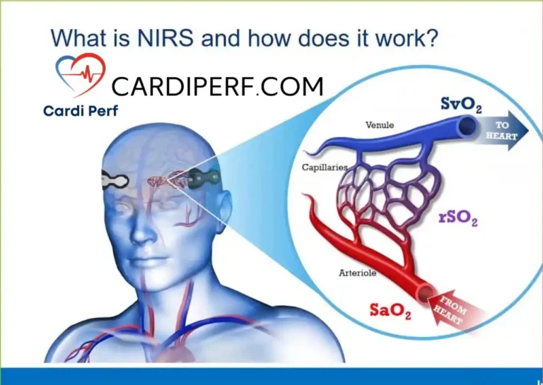 Near-Infrared Spectroscopy (NIRS) being used for cerebral oxygenation monitoring during cardiac surgery.