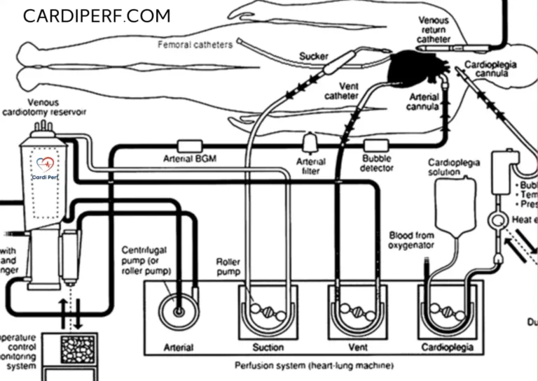 Cardiopulmonary bypass circuit with oxygenator, blood pump, reservoir, tubing, and cannulae